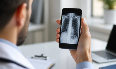 Raio-X pelo iPhone: Tecnologia Médica