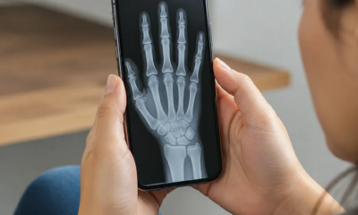 Simule Raio-X no iOS com Apps Realistas