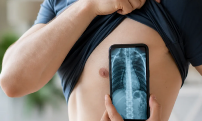 Veja o esqueleto dentro do seu corpo com este app incrível