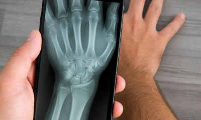 Aplicativo de Raio-X pela Câmera para Android Funciona Mesmo