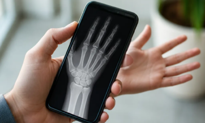 Aplicativo de Raio-X para Android: Veja Como Funciona de Verdade