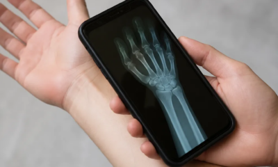 Aplicativo de Raio-X pela Câmera do Android Funciona Mesmo
