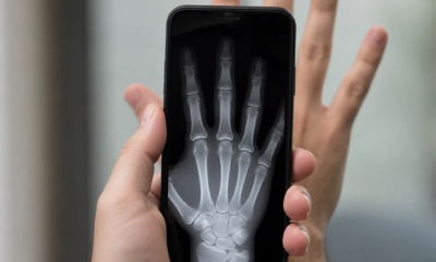 Como simular raio-X com a câmera do seu celular agora
