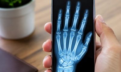 Aplicativo de Raio-X para Android: veja através das coisas com efeitos incríveis
