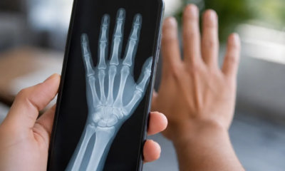 Veja os ossos do seu corpo através da câmera do celular