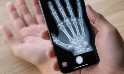 Tecnologia de raio-x agora funciona no seu iPhone