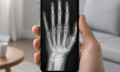 Simule Raio-X com a Câmera do iPhone em Segundos